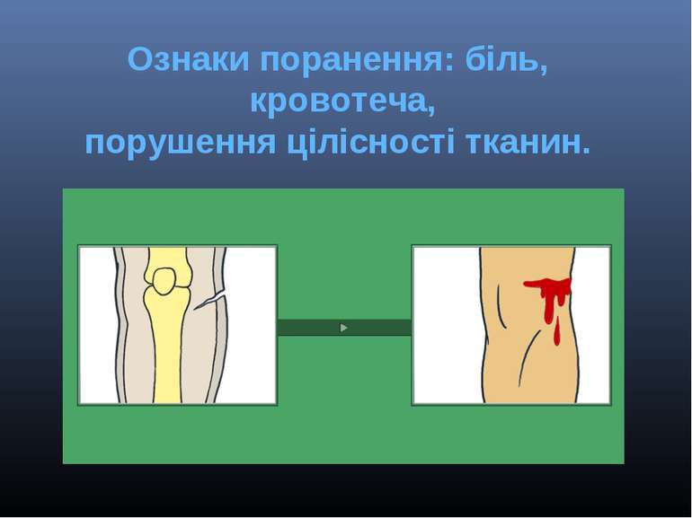 Ознаки поранення: біль,  кровотеча, порушення цілісності тканин.