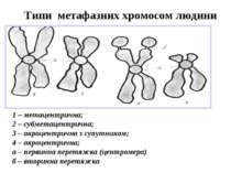 Типи метафазних хромосом людини 1 – метацентрична; 2 – субметацентрична; 3 – ...