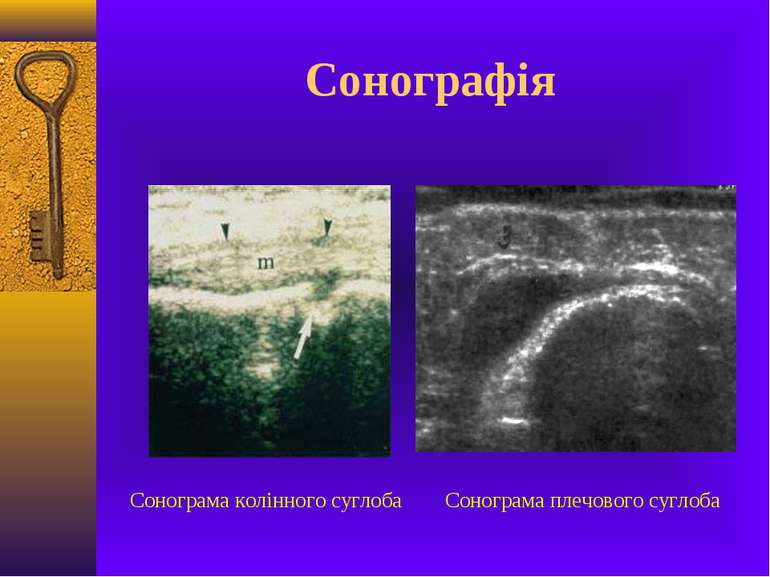 Сонографія Сонограма колінного суглоба Сонограма плечового суглоба