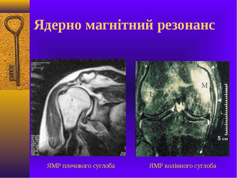 Ядерно магнітний резонанс ЯМР плечового суглоба ЯМР колінного суглоба