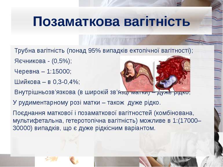 Трубна вагітність (понад 95% випадків ектопічної вагітності); Яєчникова - (0,...