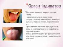 При огляді язика слід звернути увагу на: - колір; - характер нальоту на різни...