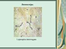 Лептоспіри. Leptospira interrogans