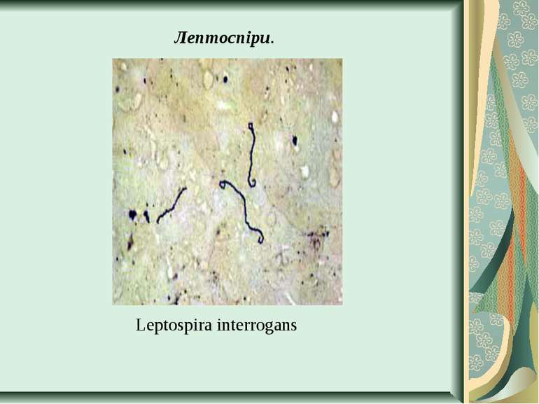 Лептоспіри. Leptospira interrogans