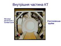 Рентгенівська трубка Матриця детекторів з коліматором Внутрішня частина КТ