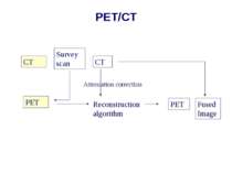 PET/CT CT PET Survey scan CT Reconstruction algorithm Attenuation correction ...