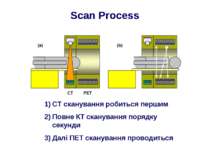 Scan Process CT сканування робиться першим Повне КТ сканування порядку секунд...