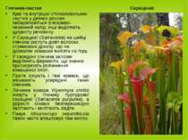 Глечики-пастки Краї та внутрішні cтінкиловильних листків у деяких рослин заба...