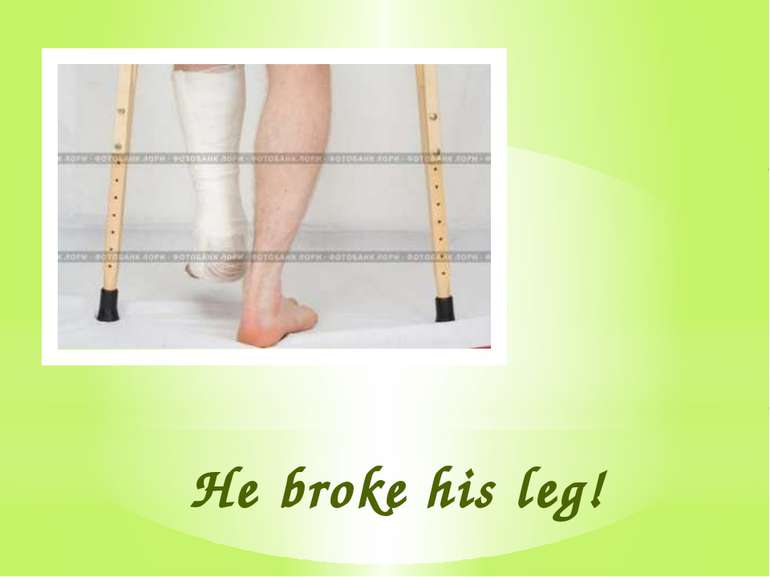 He broke his leg!