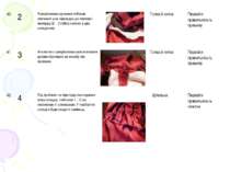 40 2 Прикріплюємо ручними стібками плечовий шов підкладки до плечової накладц...