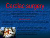 Cardiac surgery Cardiac surgery is surgery on the heart and/or great vessels ...
