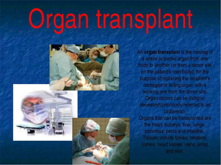 An organ transplant is the moving of a whole or partial organ from one body t...