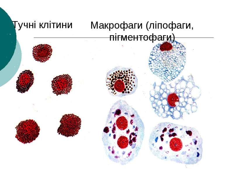 Тучні клітини Макрофаги (ліпофаги, пігментофаги)