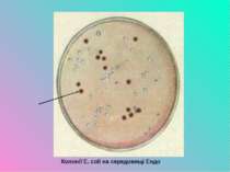 Колонії E. coli на середовищі Ендо