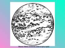 Мазок Vibrio cholerae (чиста культура)