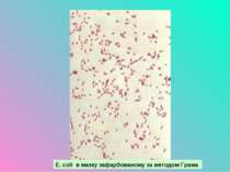 E. coli в мазку зафарбованому за методом Грама