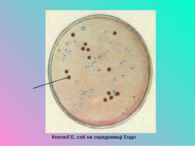 Колонії E. coli на середовищі Ендо