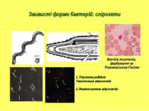 Звивисті форми бактерій: спірохети Borrelia recurrentis, фарбування за Романо...