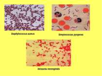 Staphylococcus aureus Streptococcus pyogenes Neisseria meningitidis