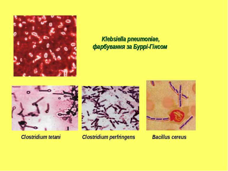 Klebsiella pneumoniae, фарбування за Буррі-Гінсом Clostridium perfringens Clo...