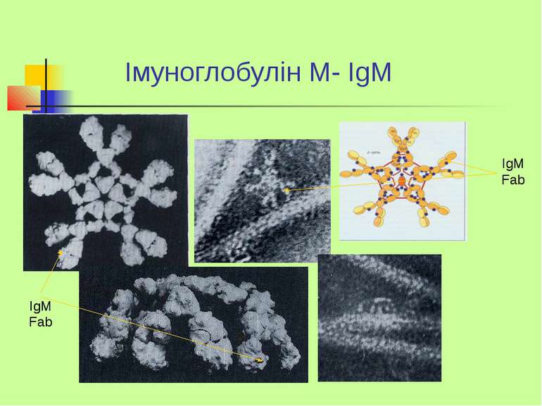 Імуноглобулін М- IgM IgM Fab IgM Fab