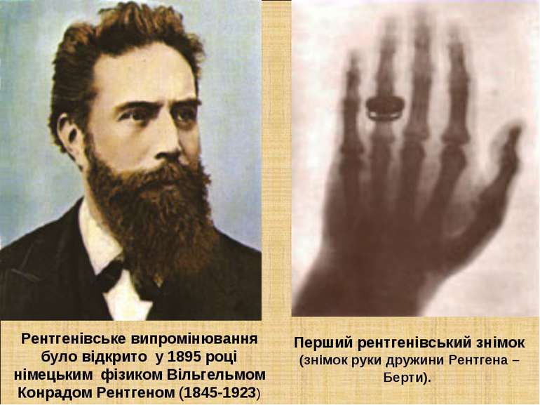 Рентгенівське випромінювання було відкрито у 1895 році німецьким фізиком Віль...