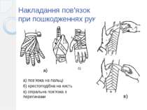 Накладання пов’язок при пошкодженнях рук б) а) пов’язка на пальці б) хрестопо...