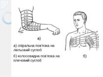 а) спіральна пов'язка на ліктьовий суглоб б) колосовидна пов'язка на плечовий...