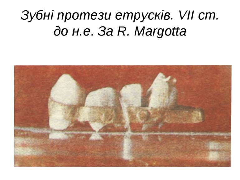 Зубні протези етрусків. VII ст. до н.е. За R. Margotta