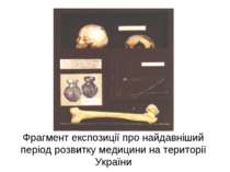 Фрагмент експозиції про найдавніший період розвитку медицини на території Укр...