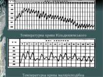 Температурна крива малярієподібна Температурна крива Кільдюшевського