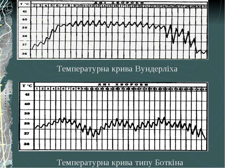 Температурна крива Вундерліха Температурна крива типу Боткіна