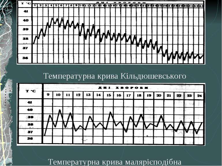Температурна крива малярієподібна Температурна крива Кільдюшевського