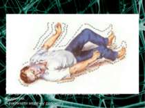 ЕПІЛЕПСІЯ Епілепсією називають захворювання нервової системи, що супроводжуєт...