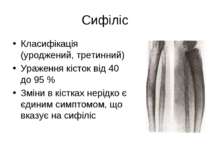 Сифіліс Класифікація (уроджений, третинний) Ураження кісток від 40 до 95 % Зм...