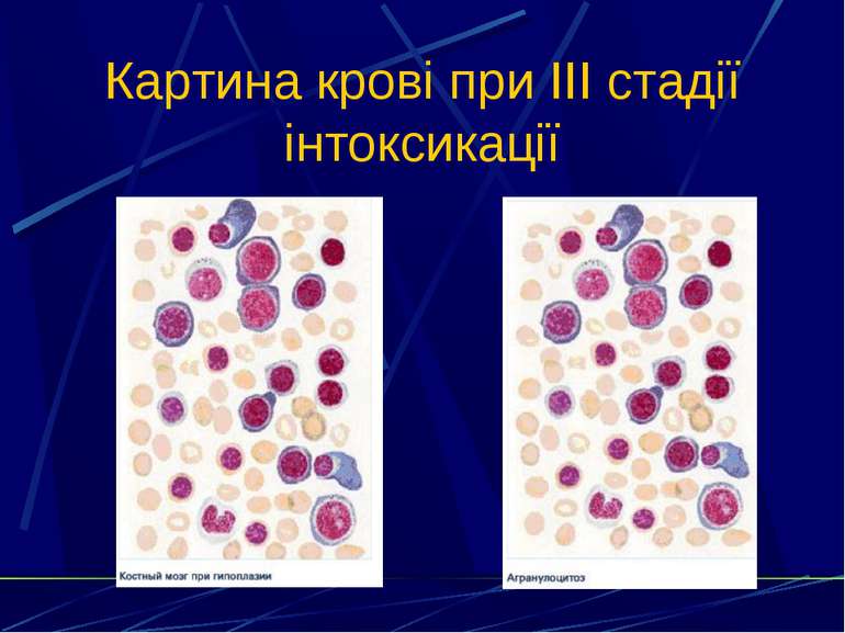 Картина крові при III стадії інтоксикації