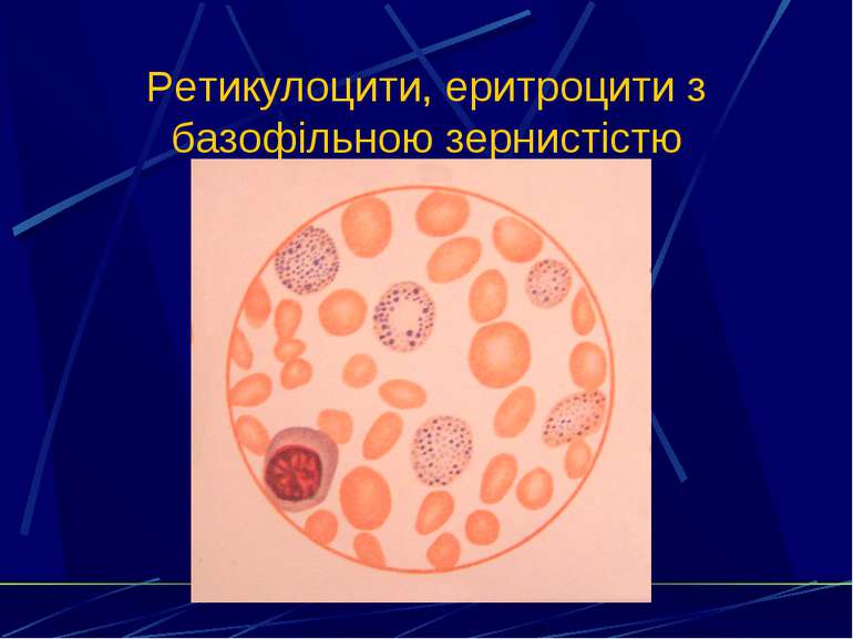 Ретикулоцити, еритроцити з базофільною зернистістю