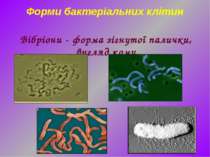 Форми бактеріальних клітин Вібріони - форма зігнутої палички, вигляд коми
