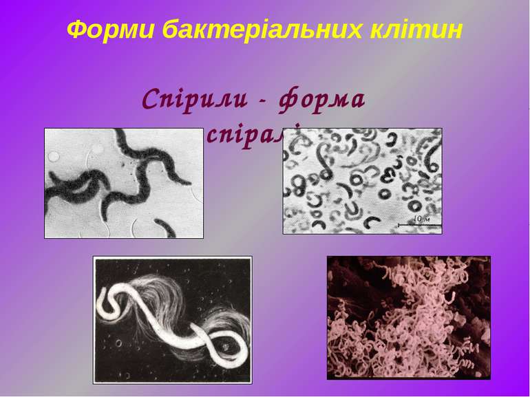 Форми бактеріальних клітин Спірили - форма спіралі