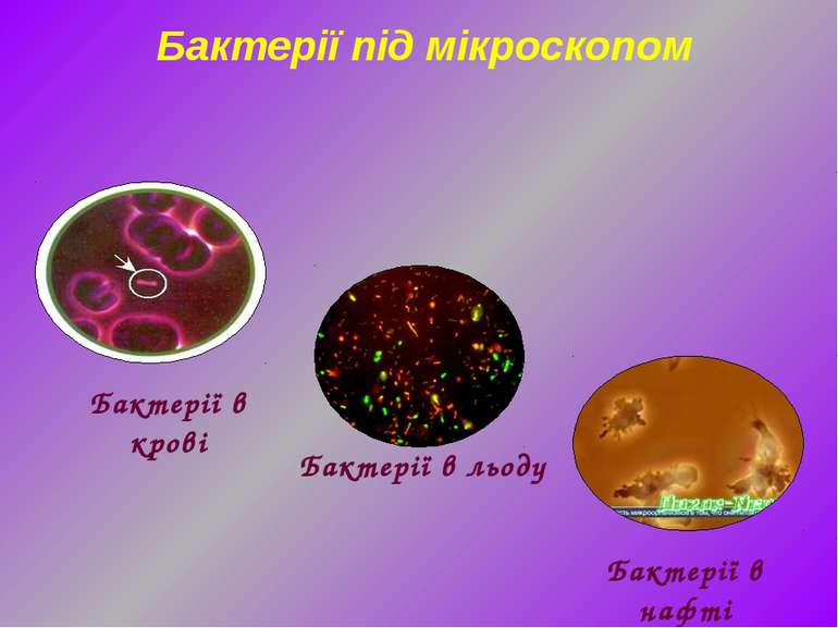 Бактерії під мікроскопом Бактерії в нафті Бактерії в крові Бактерії в льоду