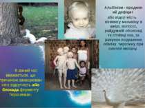 Альбінізм - вроджений дефіцит або відсутність пігменту меланіну в шкірі, воло...