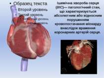 Ішемічна хвороба серця (ІХС)— патологічний стан, що характеризується абсолютн...