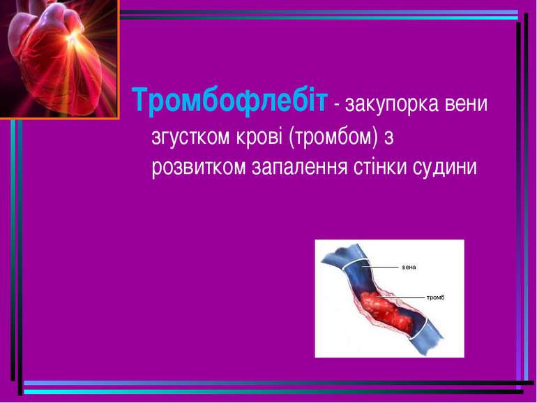 Тромбофлебіт - закупорка вени згустком крові (тромбом) з розвитком запалення ...