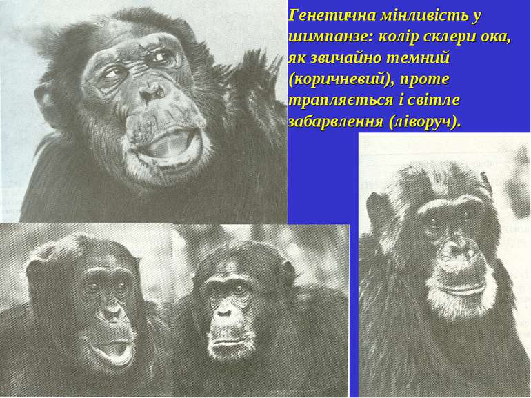Генетична мінливість у шимпанзе: колір склери ока, як звичайно темний (коричн...