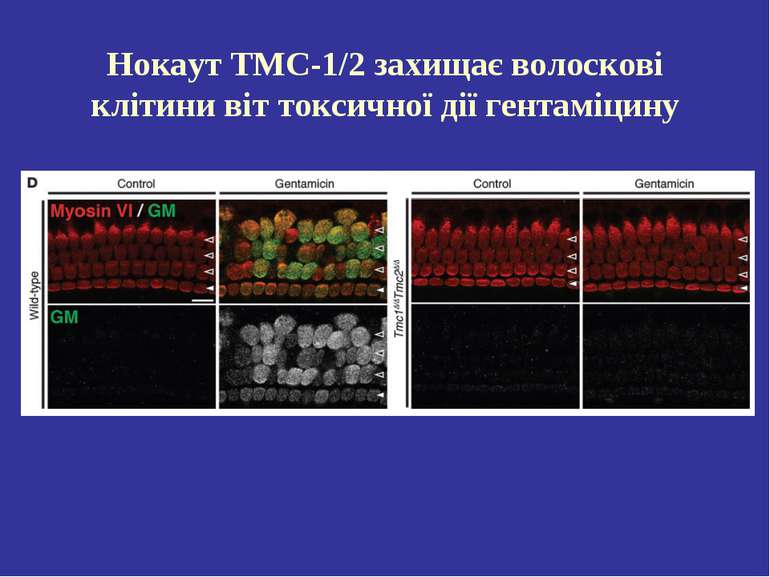 Нокаут ТМС-1/2 захищає волоскові клітини віт токсичної дії гентаміцину