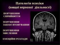 Патологія психіки (вищої нервової діяльності) ПОРУШЕННЯ СПРИЙНЯТТЯ ПОРУШЕННЯ ...