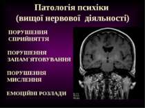 Патологія психіки (вищої нервової діяльності) ПОРУШЕННЯ СПРИЙНЯТТЯ ПОРУШЕННЯ ...
