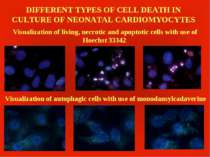 DIFFERENT TYPES OF CELL DEATH IN CULTURE OF NEONATAL CARDIOMYOCYTES Visualiza...