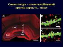Синаптоподін – актин-асоційований протеїн нирок та... мозку