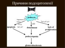 Причини подоцитопенії